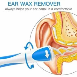 Fei Yu Nettoyant Oreille - Q Grips Nettoyant, Oreilles Appareil Reutilisable Avec Tige Souple En Silicone X16 - Nettoyeur Pour Oreilles Enfant, Adulte - Nettoyage Ear Wax Cleaner 8 Fei Yu Nettoyant Oreille - Q Grips Nettoyant, Oreilles Appareil Reutilisable Avec Tige Souple En Silicone X16 - Nettoyeur Pour Oreilles Enfant, Adulte - Nettoyage Ear Wax Cleaner -Protection auditive et tête Soldes 2022 67324843 2